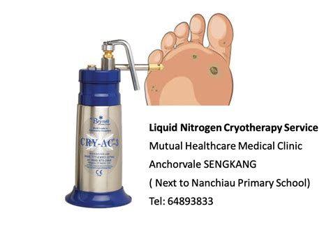 Viral Warts Treatment Liquid Nitrogen Cryotherapy Mutual Healthcare