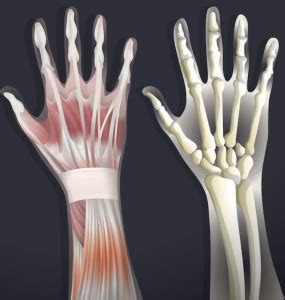 Tendon, tissue that attaches a muscle to other body parts, usually bones. Wrist Tendinopathy - Physio Works…