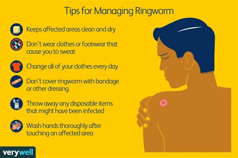 How Ringworm Is Treated 2023