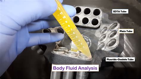 Body Fluid Analysis Introduction List Of Tests Unit And Normal