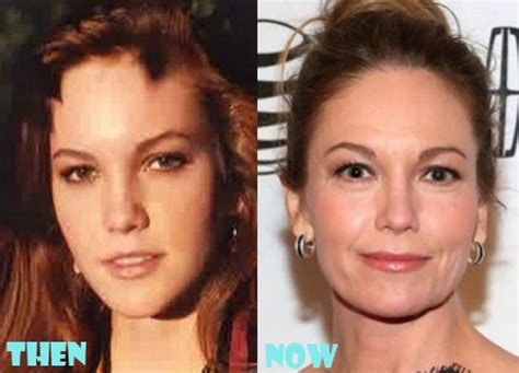 Diane Lane Plastic Surgery Before And After Photos Lovely Surgery