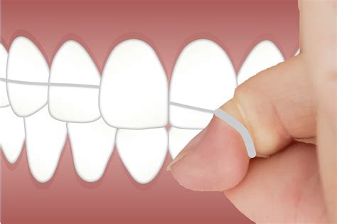 Importance In Flossing Your Teeth Properly — Union City Dental Aesthetics