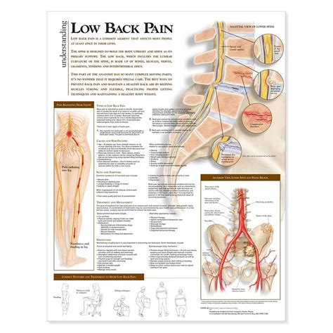 Anatomy Charts Posters Understanding Low Back Pain Anatomical Chart