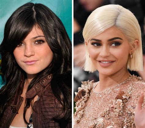 Kardashian Sisters Whos Gotten The Most Surgery