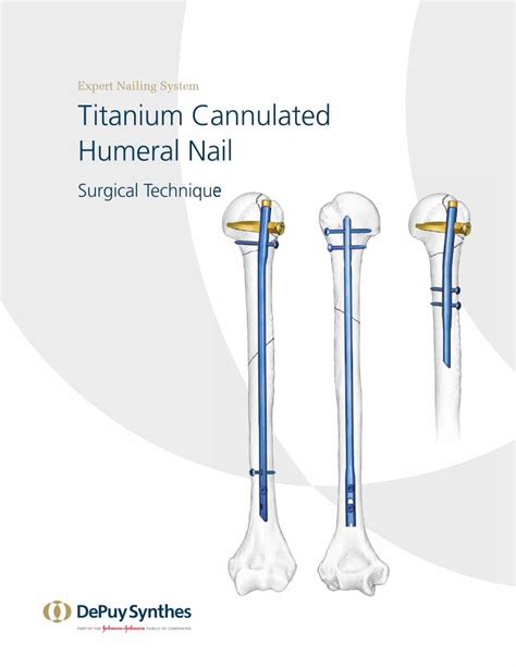 Pdf Expert Nailing System Titanium Cannulated Humeral Nailsynthesvo