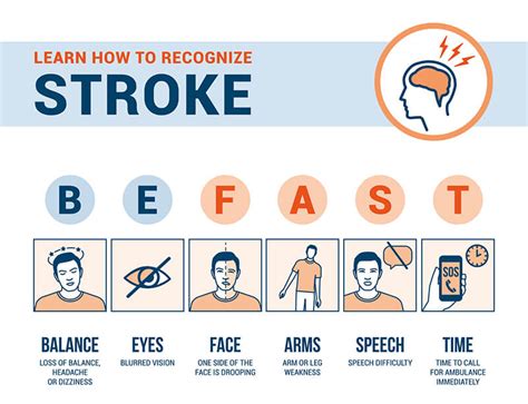 Knowing The Symptoms Of A Stroke Homewatch Caregivers