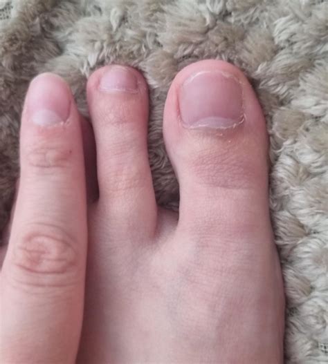 My Toes Are So Long And Bendy New Toe Upload Link In Comments R