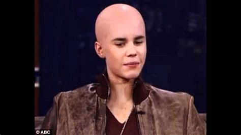 Justin Bieber Gone Bald Omg Youtube