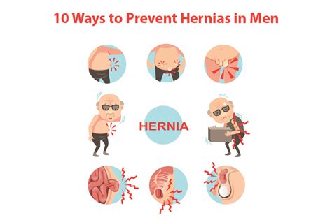 10 Ways To Prevent Hernias In Men Dr Abhijit Gotkhinde