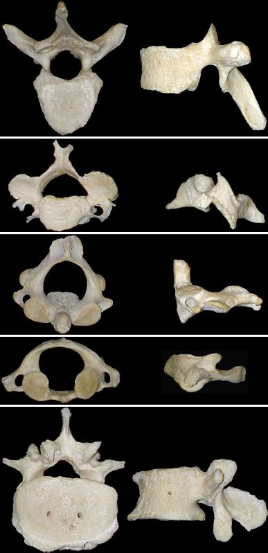 Types Of Vertebrae Diagram Diagram Quizlet