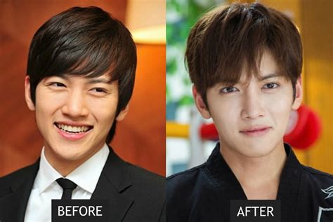 21 Korean Celebs Who Have Undergone Cosmetic Procedures Or Surgery Koreaboo