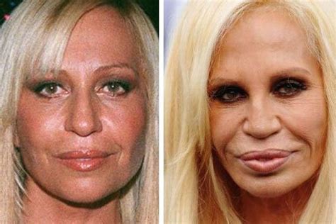 Donatella Versace Plastic Surgery Before After Why Donatella Why Donatella Versace