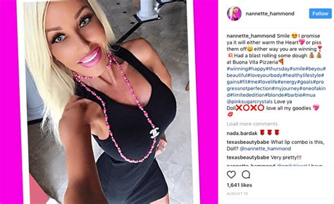 Human Barbie Reveals What She Looked Like Before 500000 Of Plastic Surgery