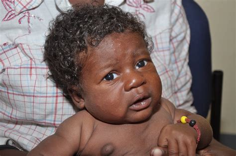 Dying In Haiti Haitis Displaced Babies
