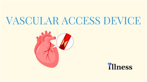 Vascular Access Device