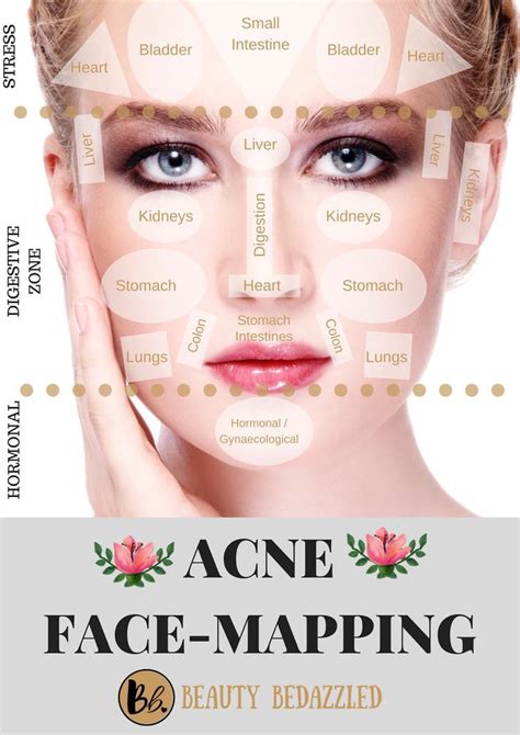 Acne Face Mapping What Does Your Acne Tell You Acne Face Map Female