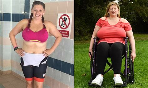 Ex Triathlete 26 Says Her 42i Breasts Have Made Her Spine Collapse And Put Her In A Wheelchair