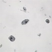 Entamoeba histolytica Trofozoites, Smear Microscope Slide : Amazon.com ...