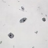 Entamoeba histolytica Trofozoites, Smear Microscope Slide : Amazon.com ...
