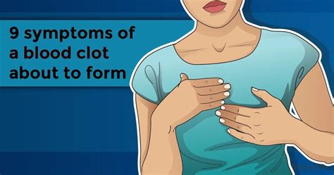 9 Clear Symptoms Of A Blood Clot About To Form