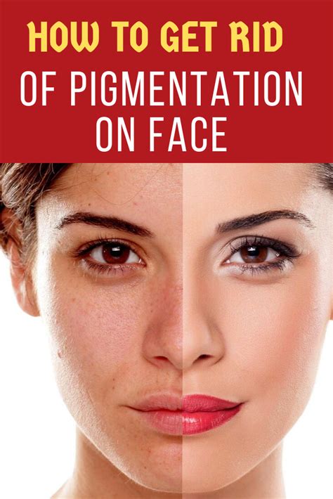 13 Home Remedies To Remove Pigmentation Naturally At Home Trabeaulli