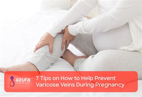7 Tips On How To Help Prevent Varicose Veins During Pregnancy