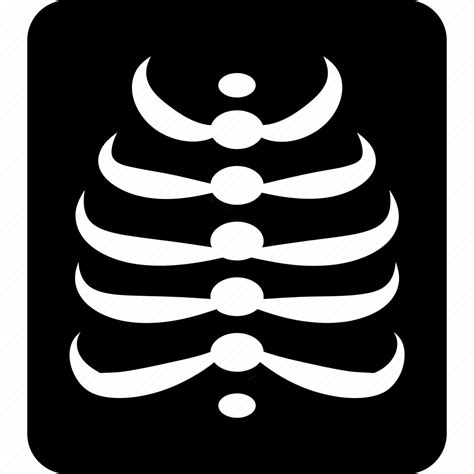 Skiagram Roentgenogram Radiograph Chest Ray Radiogram Picture