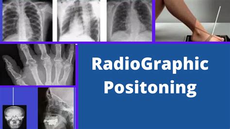 Radiographic Positioning Its Terminologies And Importance Shamsaali Blog
