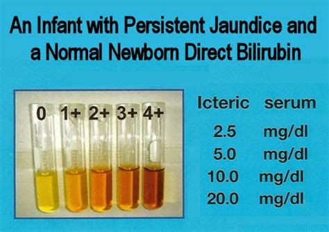 Medical Laboratory And Biomedical Science An Infant With Persistent