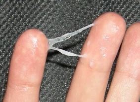 Slight bleeding or discharge accompanied by slight blood. whorlqozx - fertile mucus before ovulation