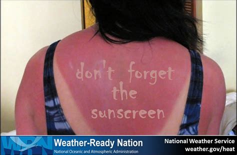 Today Is Dontfryday Dont Forget To Wear Sunscreen When Spending Time Outdoors Easier To Burn