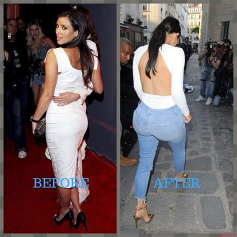 Kim Kardashian Plastic Surgery Photos Before After Surgery