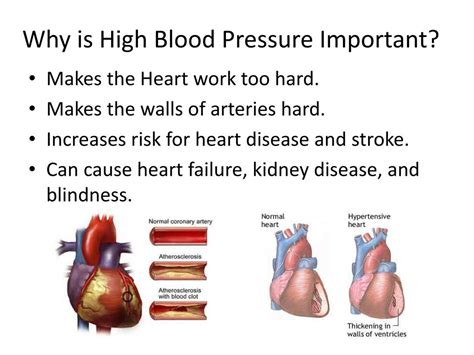 Ppt Diet And Hypertension Powerpoint Presentation Free Download Id
