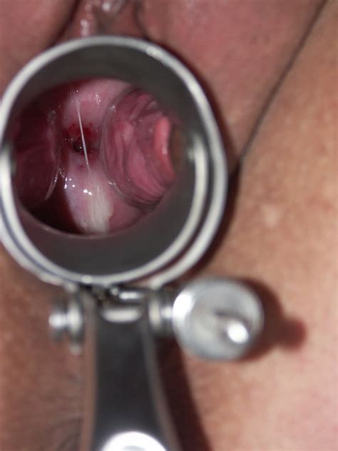 Gynecology Tits And Nylon Fetish Porn Pictures Xxx Photos Sex Images 3855812 Pictoa