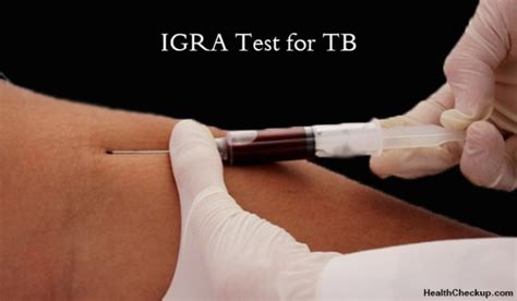 Interferon Gamma Release Assays Igras Test For Tuberculosis Health