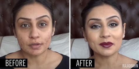 The 30 Best Concealers That Will Completely Cover Your Acne