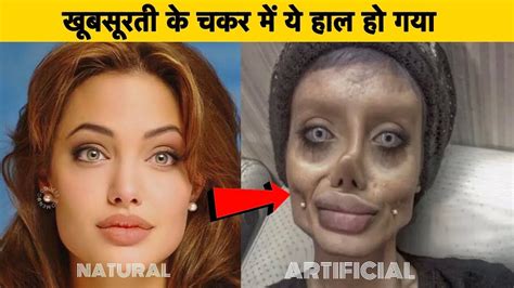 Worst Plastic Surgery Fails खूबसूरती के चकर में हो गयी गलत सर्जरी Failed Plastic Surgery