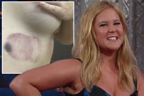 Amy Schumer Tits Sex Pictures Pass