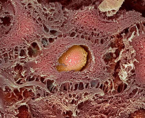 Skin Cell Sem Photograph By Steve Gschmeissner
