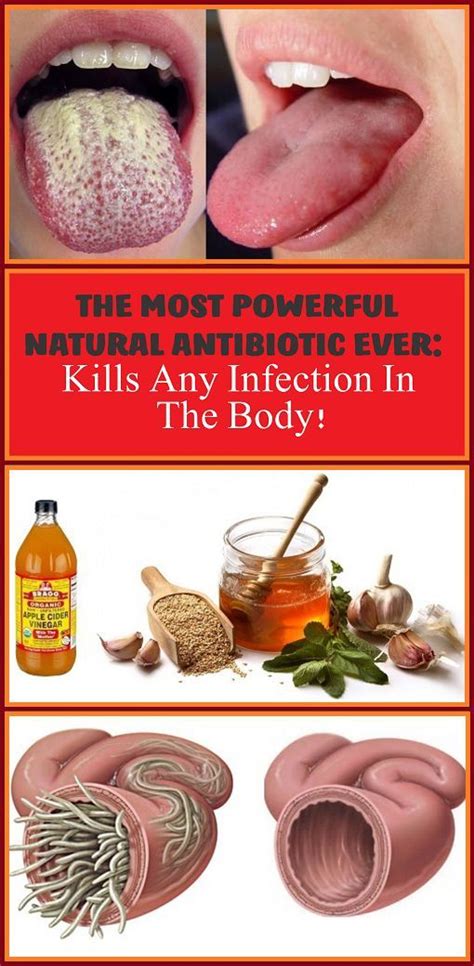 The Most Powerful Natural Antibiotic Ever Kills Any Infection In The