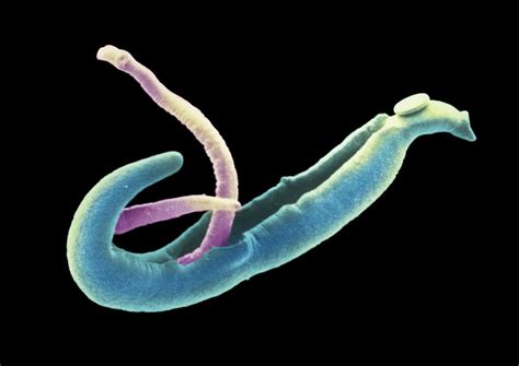Why 17 People Volunteered To Be Infected With Parasitic Worms Live