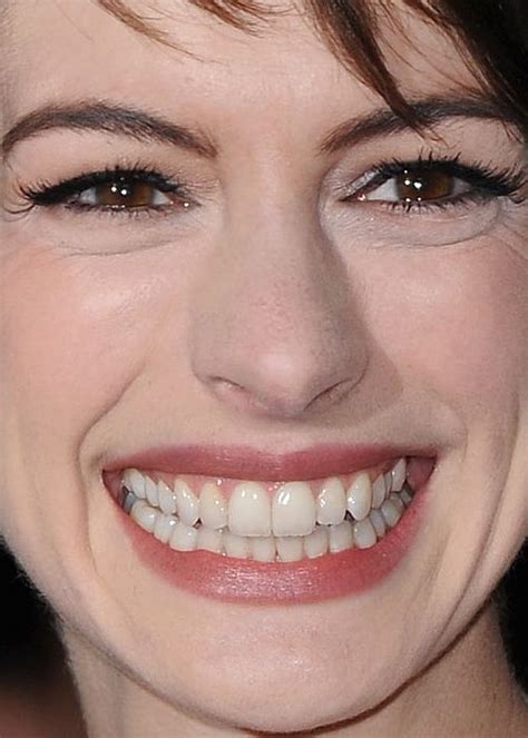 Celebritycloseup Anne Hathaway Beautiful Teeth Perfect Smile
