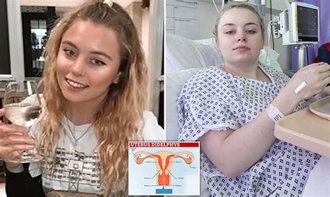 Teenager With Two Vaginas Says It Took Doctors Eight Years To Spot Her