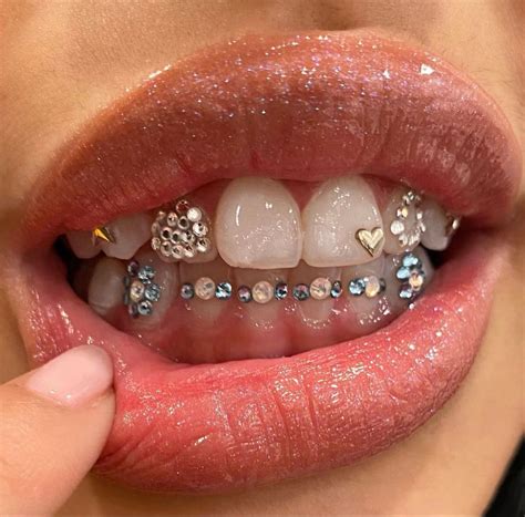 Teeth Gem Aesthetic Parrillas Para Los Dientes Joyería Para El