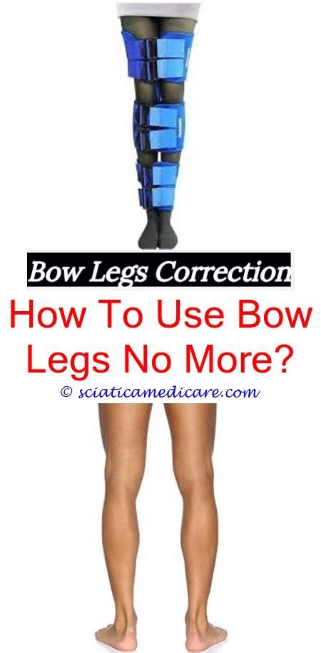 Braces For Bow Legs Bow Legged Correction Bow Legged Knock Knees