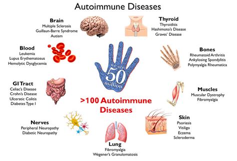Auto Immune Disease What Causes It Remede Wellness Medicine