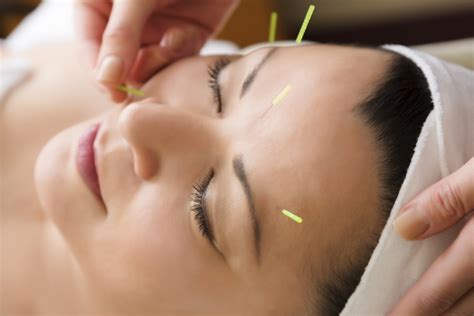 Acupuncture Dasha Wellness®