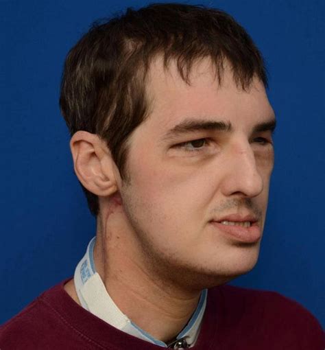 woman sees dead brother s face on another man s body thanks to groundbreaking transplant world