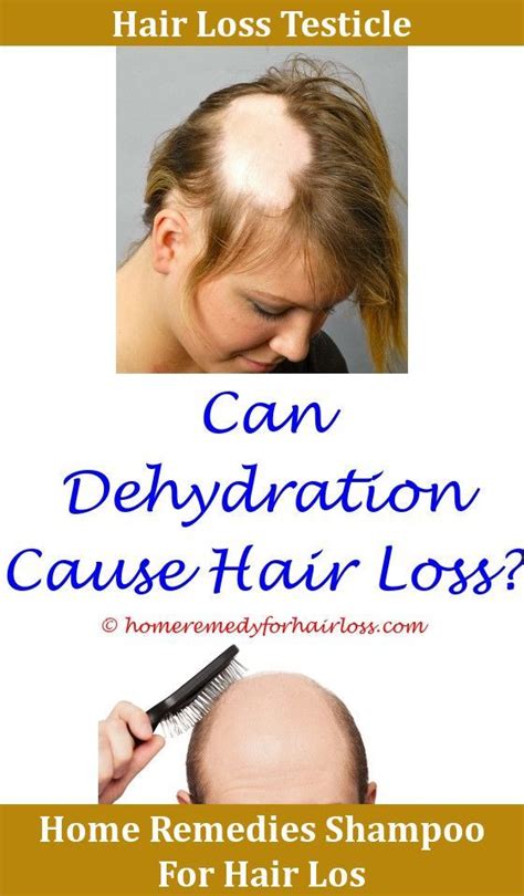 I read that the medicine, levothyroxine could cause hair loss and weight gain among all the other symptoms. Hair Loss Levothyroxine