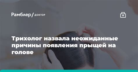 Трихолог назвала неожиданные причины появления прыщей на голове Рамблер доктор